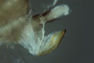 Bild 4 Sägeartiger Eiablageapparat des Weibchens in Vergrößerung mit deutlich sichtbaren Sägezähnen